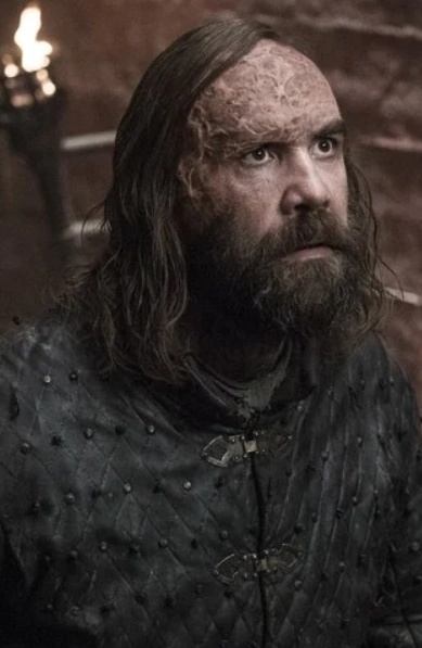 Sandor Clegane - AI Character on RolePlai